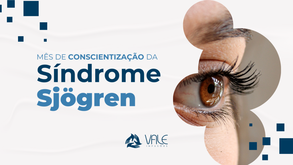 sindome de sjogren