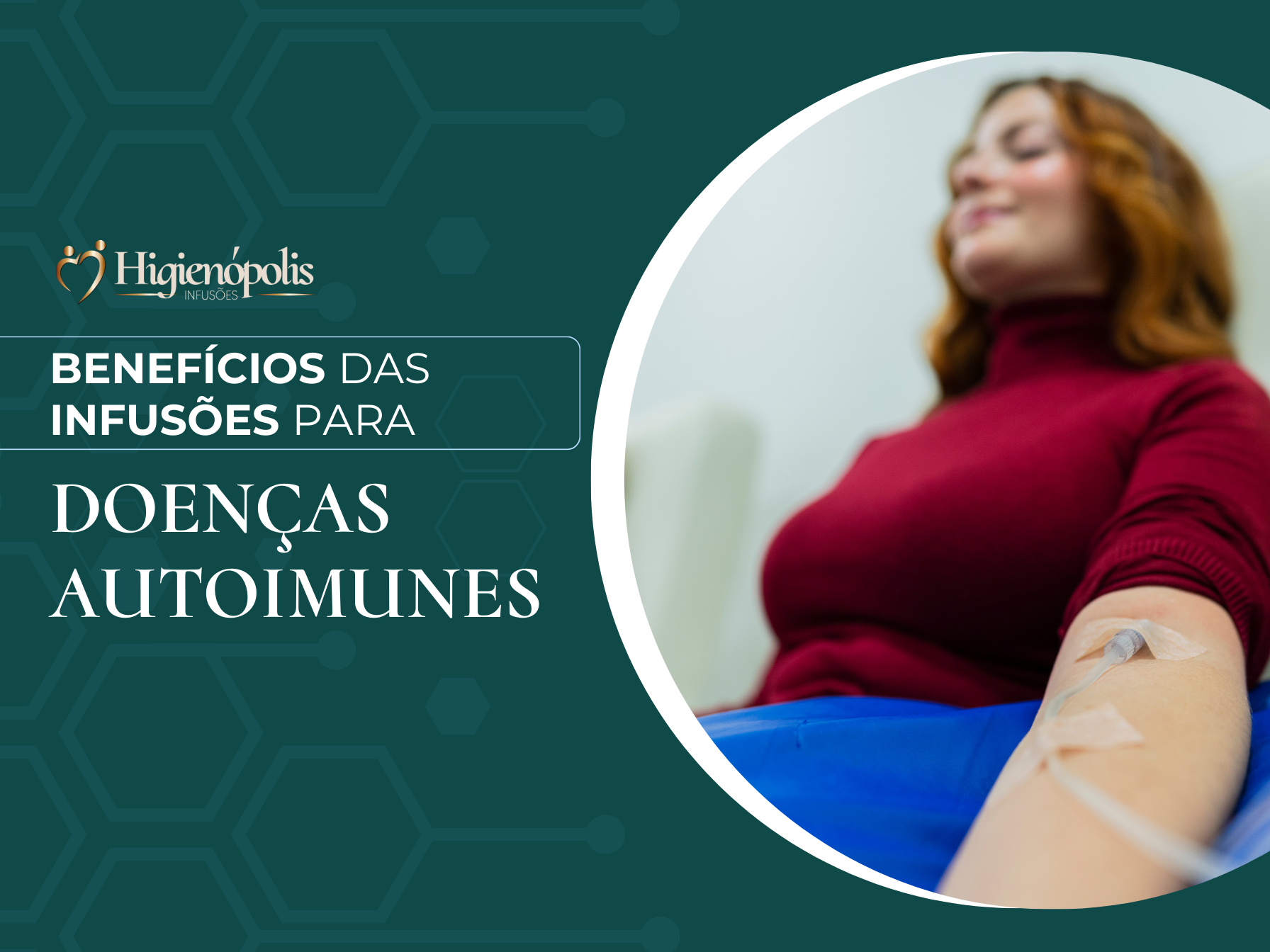 Infusoes Benefícios das Infusões para Doenças Autoimunes - Higienópolis Infusões